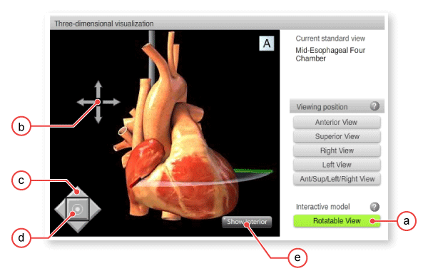 figure 1: Interactive heart model